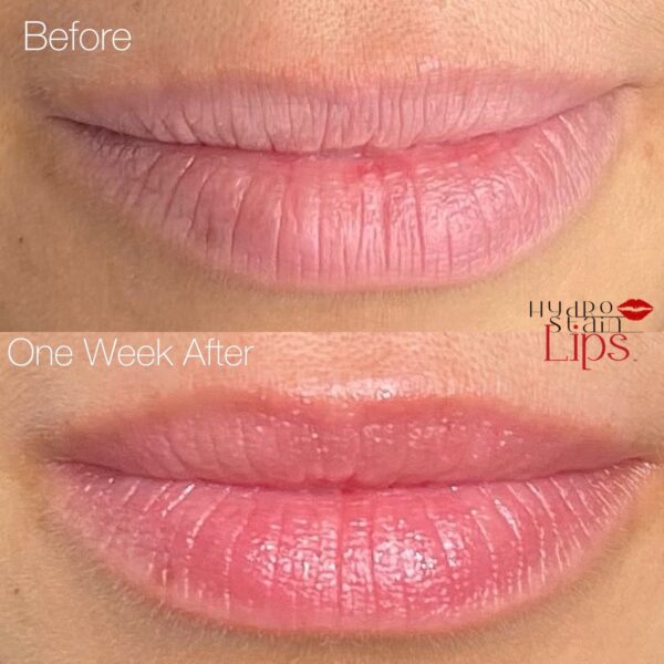 Before and One Week After