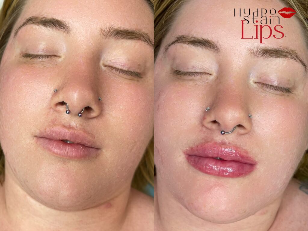 HydroStain Lips Before and After